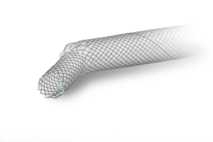 Tracheal Stent